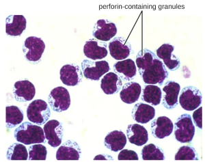 Natural killer cell with perforin-containing granules.