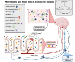 Overview of the gut–brain axis in Parkinson’s disease.