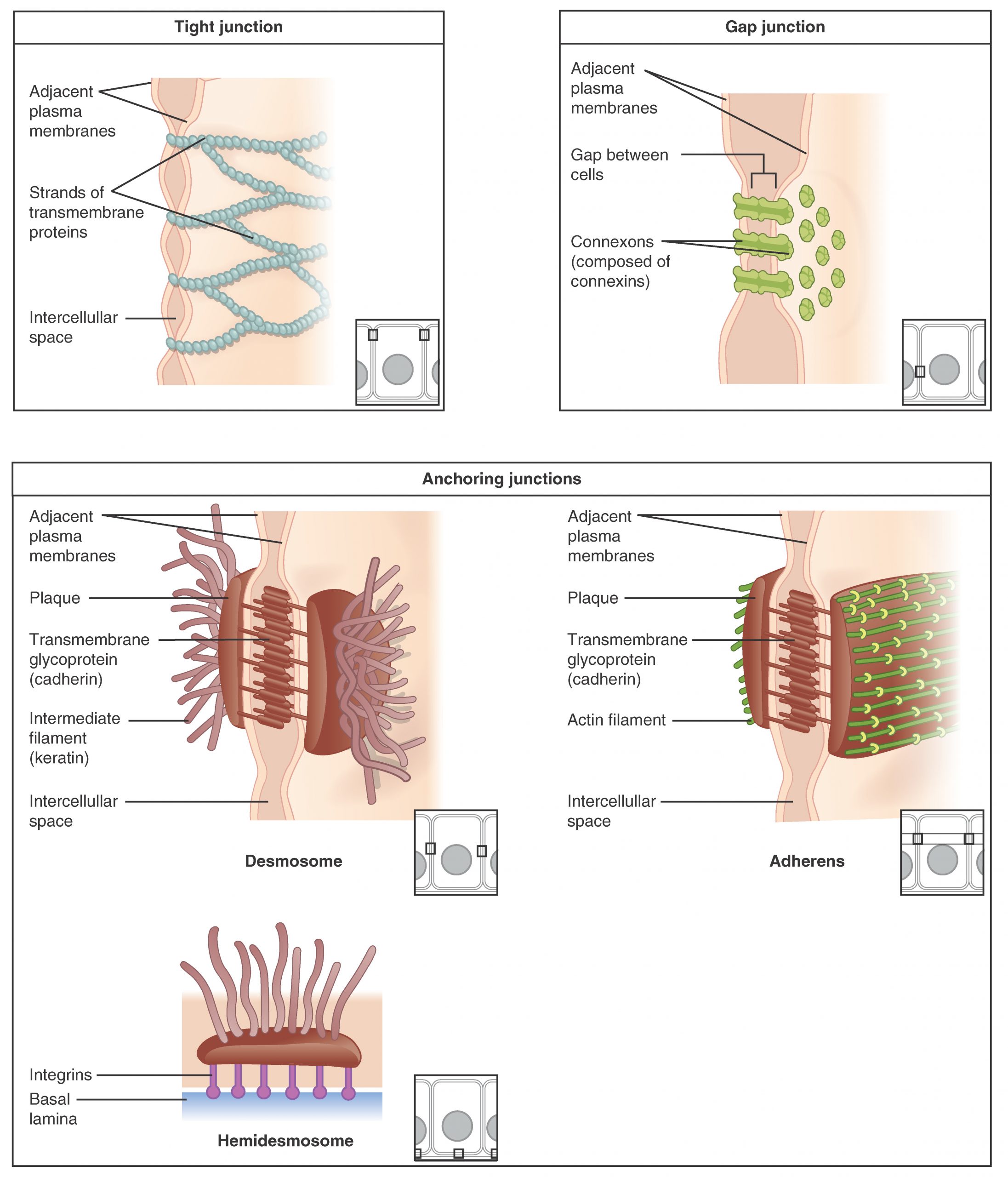These three illustrations each show the edges of two vertical cell membranes. The cell membranes are viewed partially from the side so that the inside edge of the right cell membrane is visible. The upper left image shows a tight junction. The two cell membranes are bound by transmembrane protein strands. The proteins travel the inside edge of the right cell membrane and cross over to the left cell membrane, cinching the two membranes together. The cell membranes are still somewhat separated in between neighboring strands, creating intercellular spaces. The upper right diagram shows a gap junction. The gap junctions are composed of two interlocking connexins, which are round, hollow tubes that extend through the cell membranes. Two connexins, one from the left cell membrane and the other from the right cell membrane, meet between the two cells, forming a connexon. Even at the site of the connexon, there is a small gap between the cell membranes. On the inside edge of the right cell membrane, the gap junction appears as a depression. Three connexins are embedded into the membranes like buttons on a shirt. The bottom images show the three types of anchoring junctions. The left image shows a desmosome. Here, the inside edge of both the right and left cell membranes have brown, round plaques. Each plaque has tentacle-like intermediate filaments (keratin) that extend into each cell’s cytoplasm. The two plaques are connected across the intercellular space by several interlocking transmembrane glycoproteins (cadherin). The connected glycoproteins look similar to a zipped-up zipper between the right and left cell membranes. The right image shows an adheren. These are similar to desmosomes, with two plaques on the inside edge of each cell membrane connected across the intercellular space by glycoproteins. However, the plaques do not contain the tentacle-like intermediate filaments branching into the cytoplasm. Instead, the plaques are ribbed with green actin filaments. The filaments are neatly arranged in parallel, horizontal strands on the surface of the plaque facing the cytoplasm. The bottom image shows a hemidesmosome. Rather than located between two neighboring cells, the hemidesmosome is located between the bottom of a cell and the basement membrane. A hemidesmosome contains a single plaque on the inside edge of the cell membrane. Like the desmosome, intermediate filaments project from the plaque into the cytoplasm. The opposite side of the plaque has purple, knob-shaped integrins extending out to the basal lamina of the basement membrane.